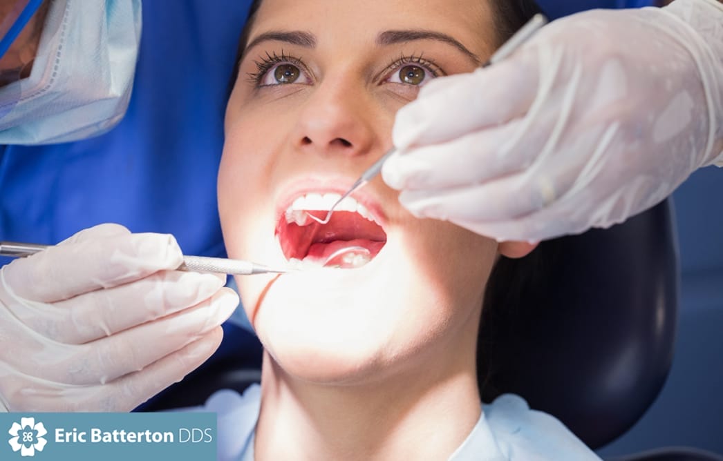 How Long Does a Dental Cleaning Take?